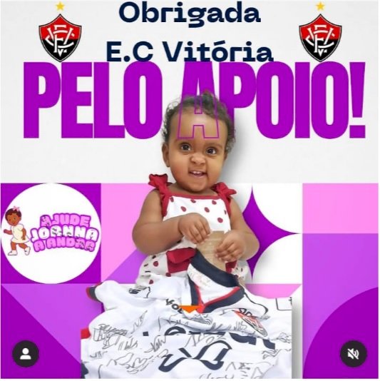 Candeias Mobilizada na Campanha Solidária: Ajude Joana a Caminhar!